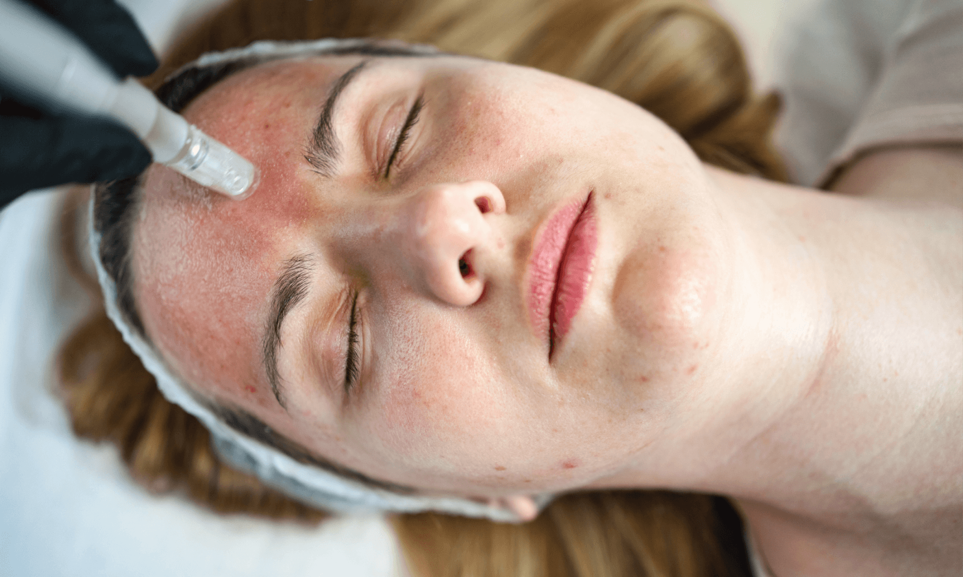 A woman lying down while a provider puts a needle in her lip